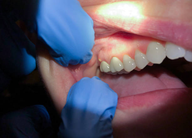 Best Emergency Cosmetic Dentistry (e.g., broken veneers) in Pine Lake Park, NJ